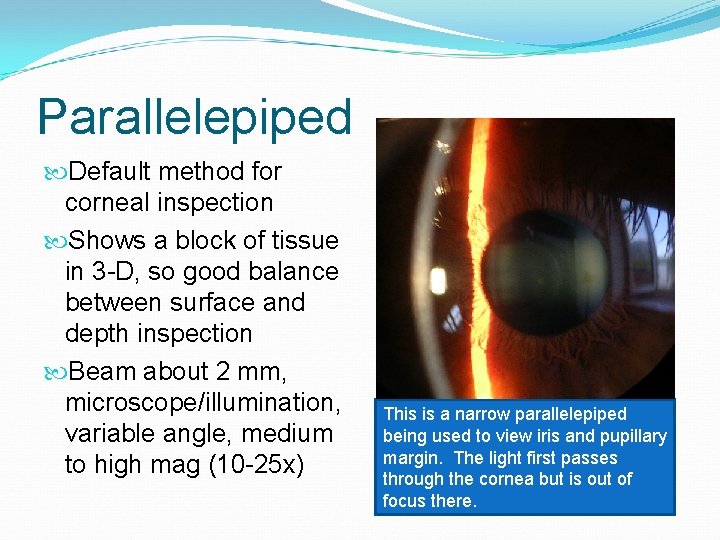 Parallelepiped Default method for corneal inspection Shows a block of tissue in 3 -D,