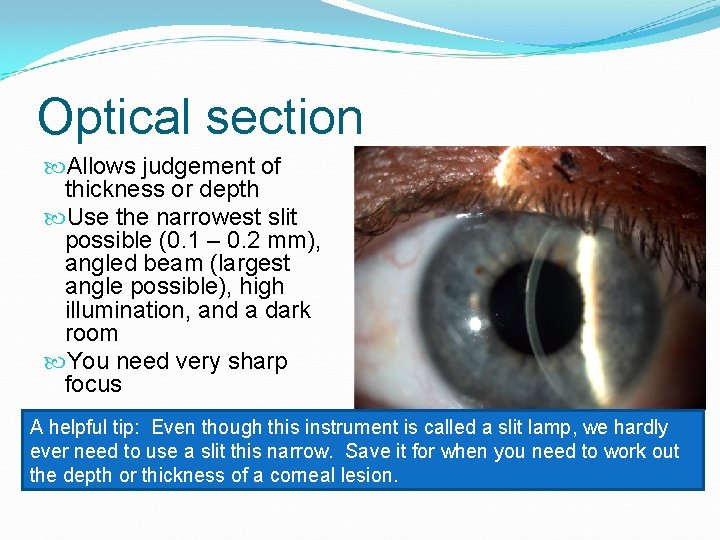 Optical section Allows judgement of thickness or depth Use the narrowest slit possible (0.