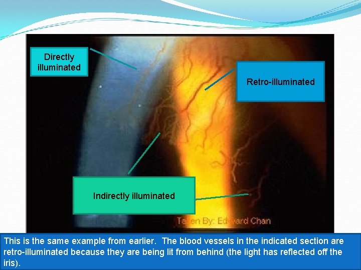 Directly illuminated Retro-illuminated Indirectly illuminated This is the same example from earlier. The blood