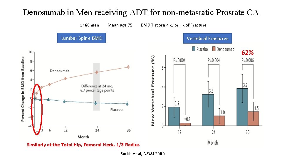 Denosumab in Men receiving ADT for non-metastatic Prostate CA 1468 men Mean age 75