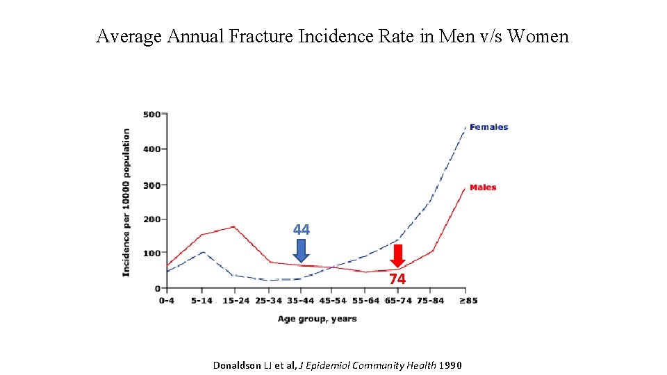 Average Annual Fracture Incidence Rate in Men v/s Women 44 74 Donaldson LJ et