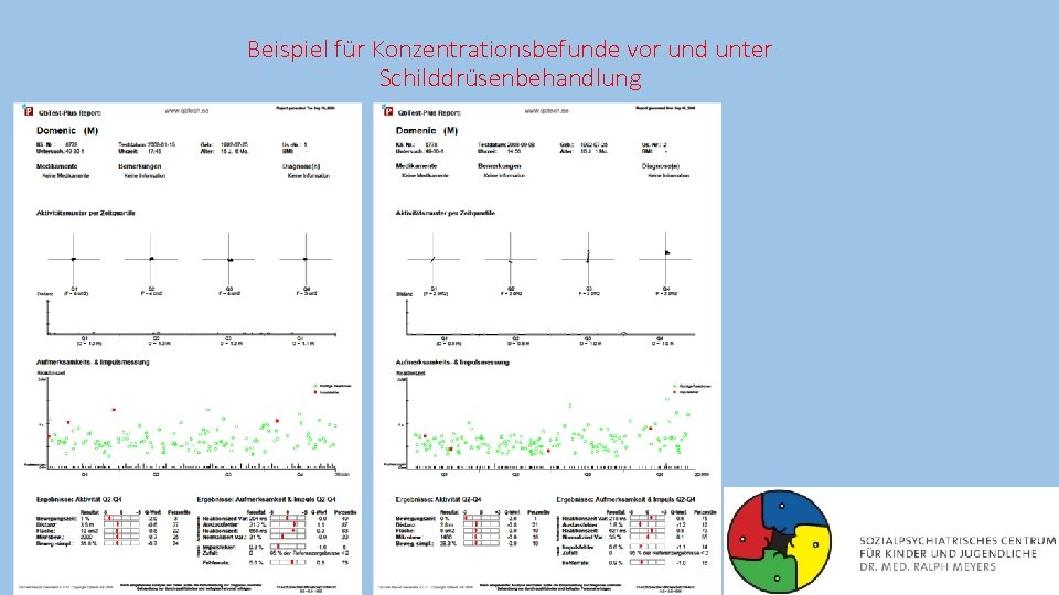 Beispiel für Konzentrationsbefunde vor und unter Schilddrüsenbehandlung 