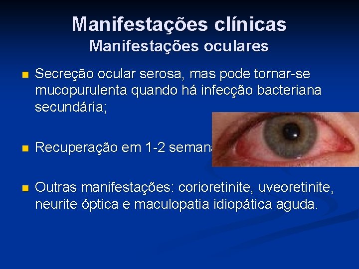 Manifestações clínicas Manifestações oculares n Secreção ocular serosa, mas pode tornar-se mucopurulenta quando há