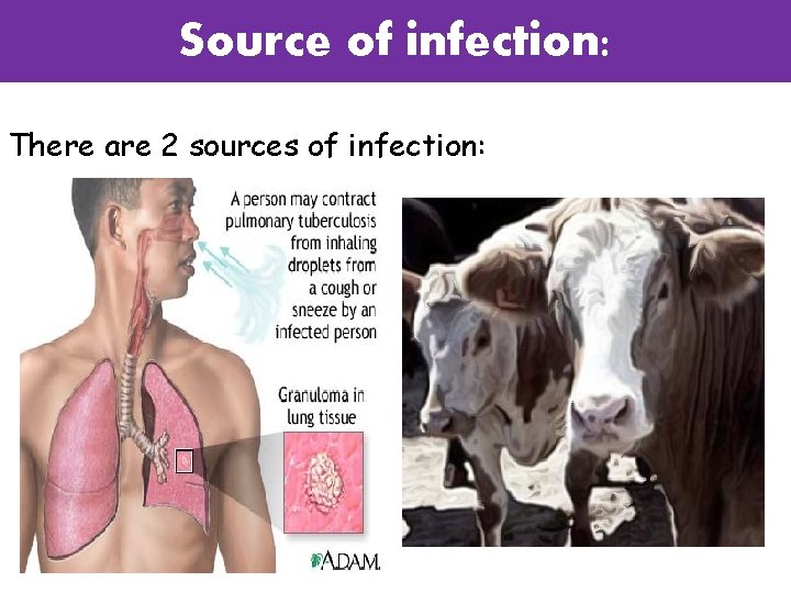 Source of infection: There are 2 sources of infection: 