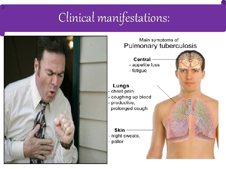 Clinical manifestations: 