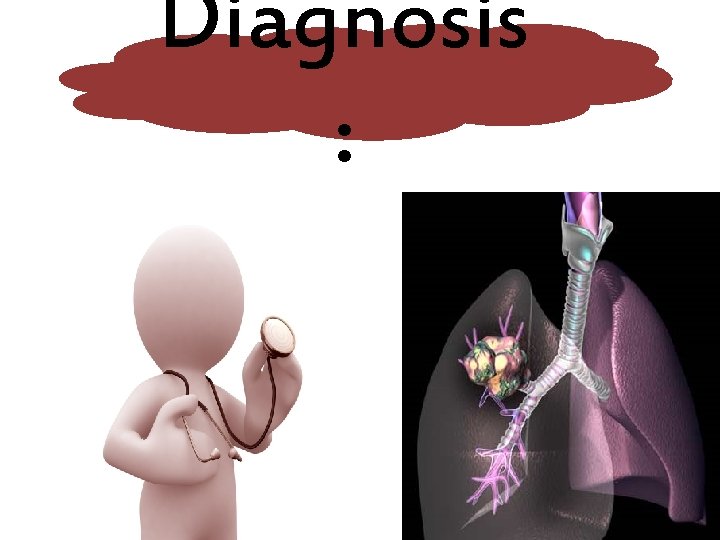 Diagnosis : 