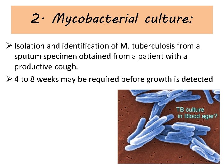 2. Mycobacterial culture: Ø Isolation and identification of M. tuberculosis from a sputum specimen