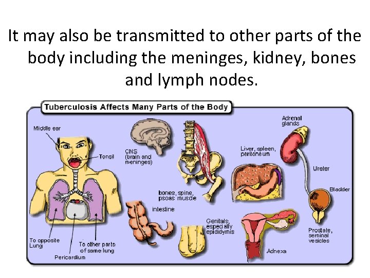 It may also be transmitted to other parts of the body including the meninges,