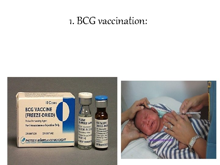 1. BCG vaccination: 