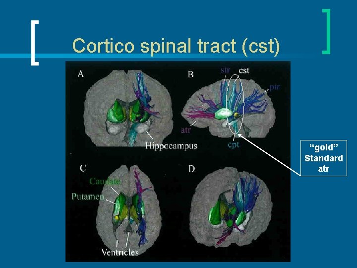 Cortico spinal tract (cst) “gold” Standard atr 
