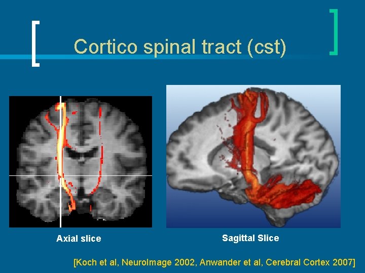 Cortico spinal tract (cst) Axial slice Sagittal Slice [Koch et al, Neuro. Image 2002,