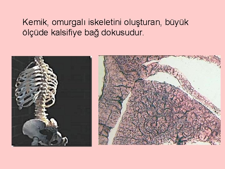 Kemik, omurgalı iskeletini oluşturan, büyük ölçüde kalsifiye bağ dokusudur. 