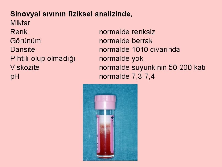 Sinovyal sıvının fiziksel analizinde, Miktar Renk normalde renksiz Görünüm normalde berrak Dansite normalde 1010