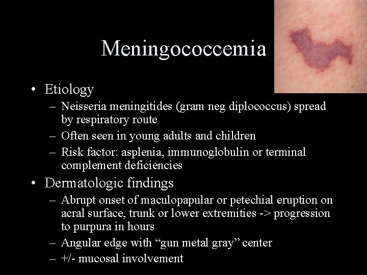 Meningococcemia • Etiology – Neisseria meningitides (gram neg diplococcus) spread by respiratory route –