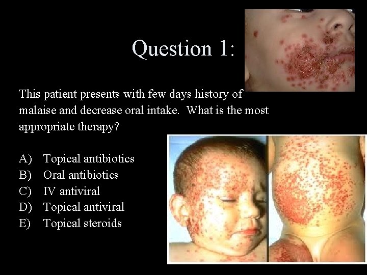 Question 1: This patient presents with few days history of malaise and decrease oral