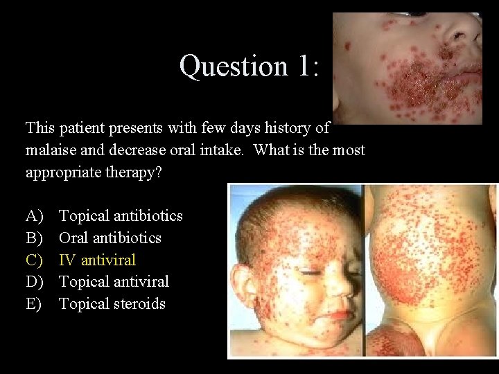 Question 1: This patient presents with few days history of malaise and decrease oral