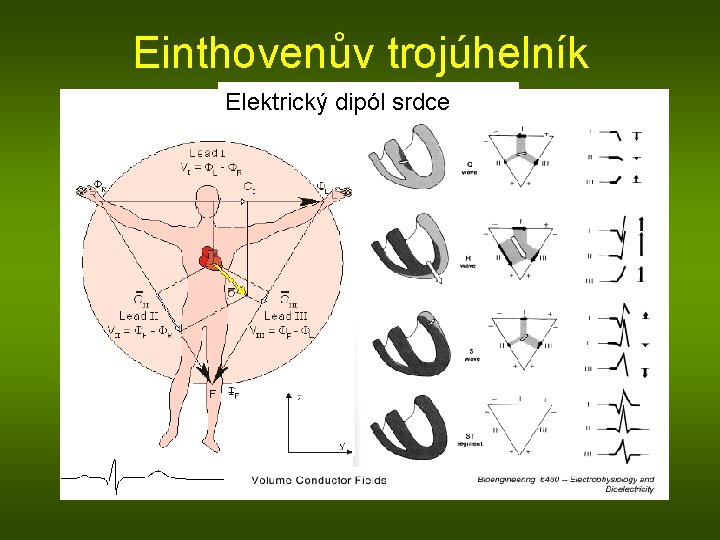 Einthovenův trojúhelník Elektrický dipól srdce 