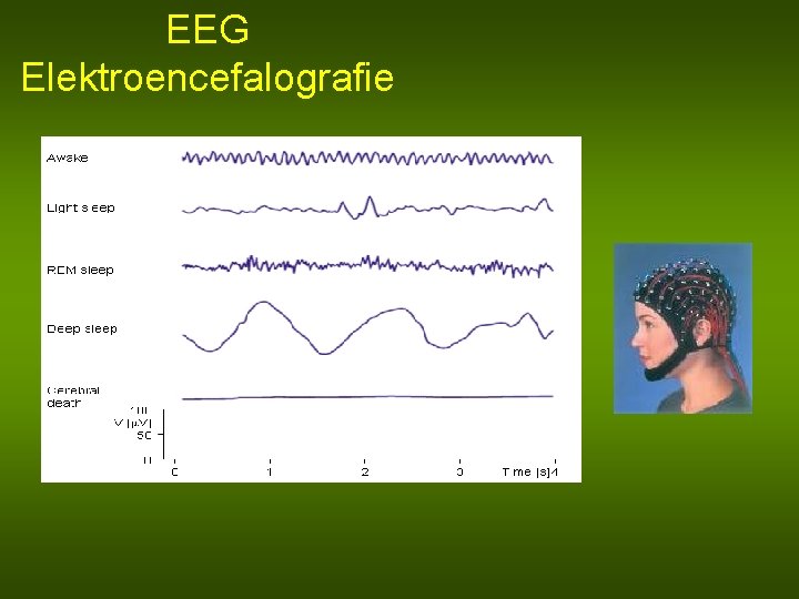EEG Elektroencefalografie 