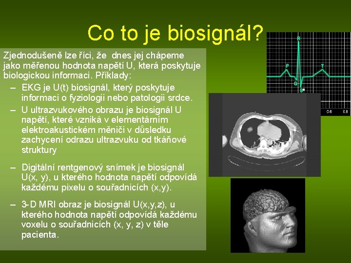 Co to je biosignál? Zjednodušeně lze říci, že dnes jej chápeme jako měřenou hodnota