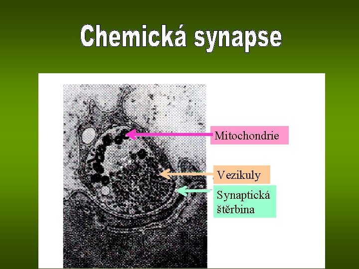 Mitochondrie Vezikuly Synaptická štěrbina 