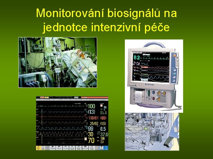 Monitorování biosignálů na jednotce intenzivní péče 