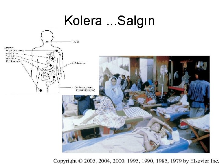 Kolera. . . Salgın 