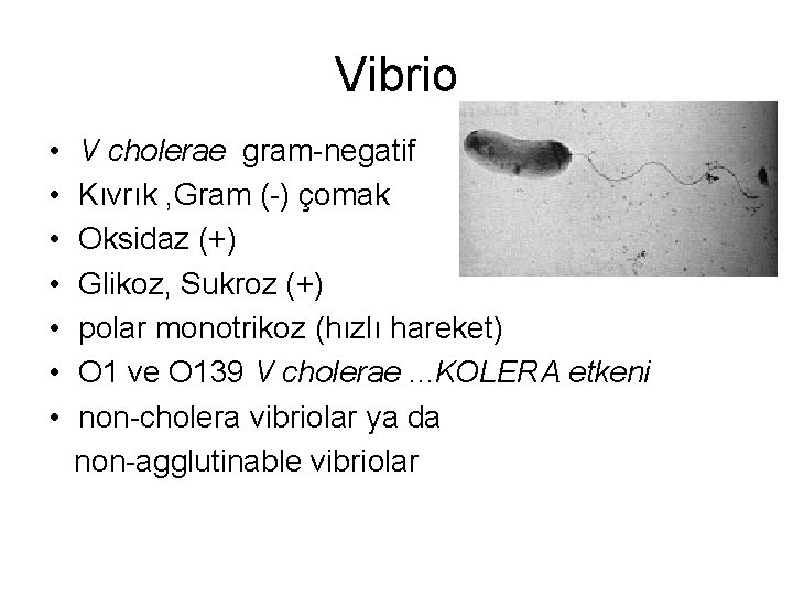 Vibrio • V cholerae gram-negatif • Kıvrık , Gram (-) çomak • Oksidaz (+)