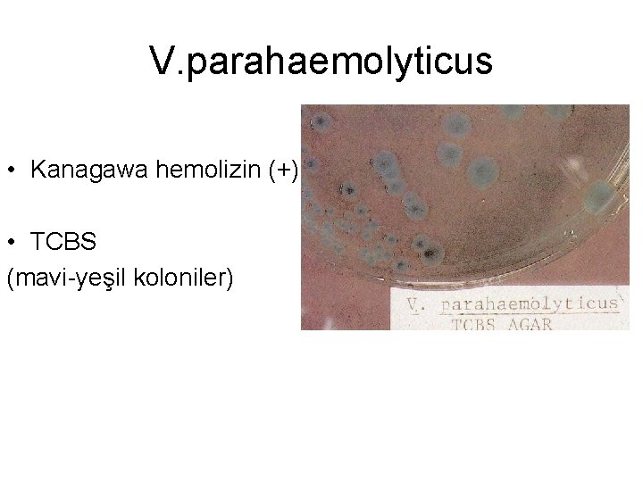 V. parahaemolyticus • Kanagawa hemolizin (+) • TCBS (mavi-yeşil koloniler) 