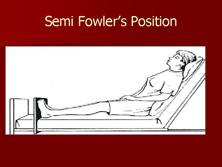 Semi Fowler’s Position 