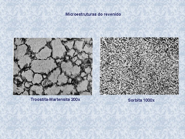 Microestruturas do revenido Troostita-Martensita 200 x Sorbita 1000 x 