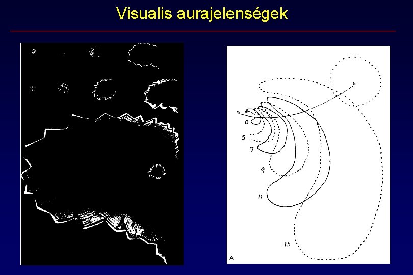 Visualis aurajelenségek Visualis aurajelenségek