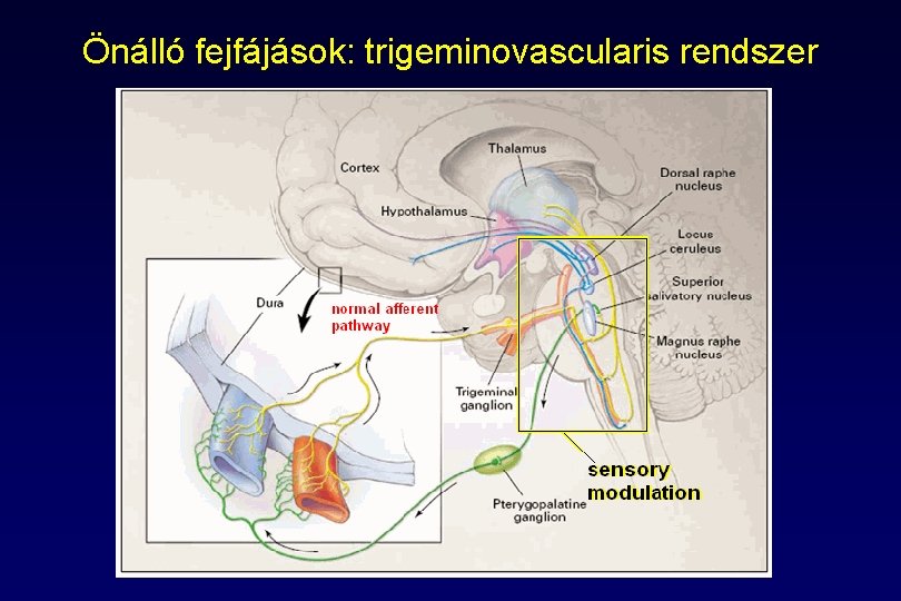 Önálló fejfájások: trigeminovascularis rendszer Önálló fejfájások: trigeminovascularis rendszer