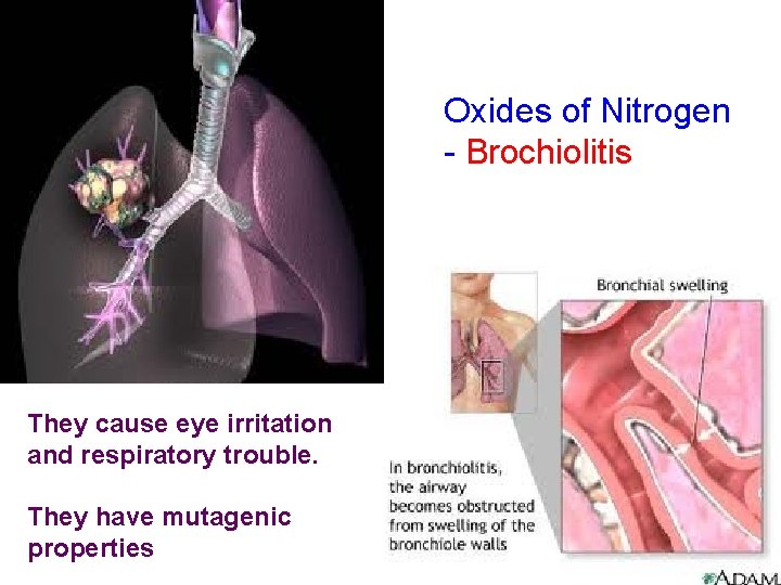 Oxides of Nitrogen - Brochiolitis They cause eye irritation and respiratory trouble. They have