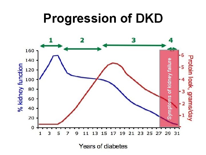 Symptoms of kidney failure Progression of DKD 