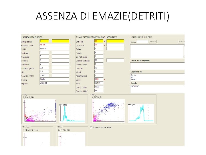 ASSENZA DI EMAZIE(DETRITI) 