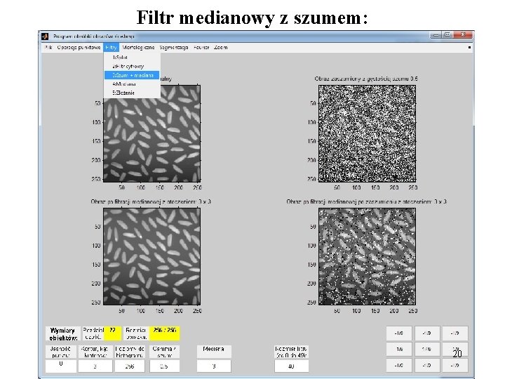 Filtr medianowy z szumem: 20 