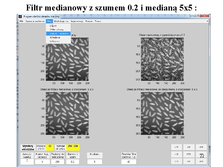 Filtr medianowy z szumem 0. 2 i medianą 5 x 5 : 22 