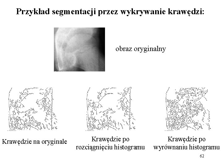 Przykład segmentacji przez wykrywanie krawędzi: obraz oryginalny Krawędzie na oryginale Krawędzie po rozciągnięciu histogramu