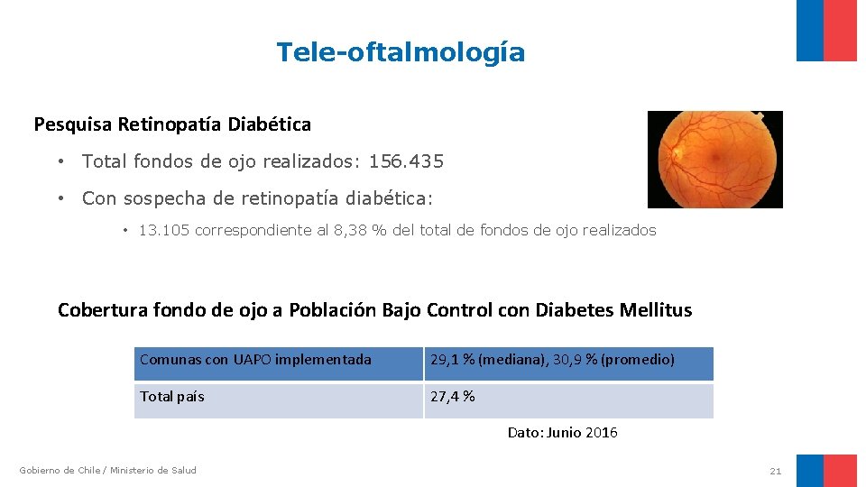 Tele-oftalmología Pesquisa Retinopatía Diabética • Total fondos de ojo realizados: 156. 435 • Con Tele-oftalmología Pesquisa Retinopatía Diabética • Total fondos de ojo realizados: 156. 435 • Con