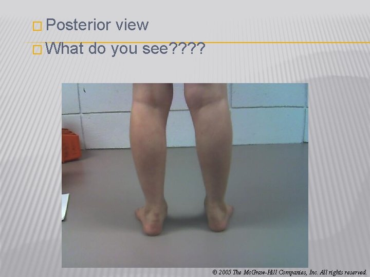 � Posterior view � What do you see? ? © 2005 The Mc. Graw-Hill