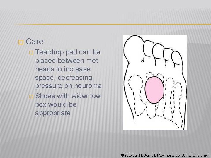 � Care Teardrop pad can be placed between met heads to increase space, decreasing