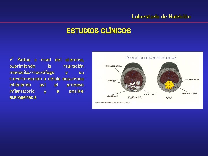 Laboratorio de Nutrición ESTUDIOS CLÍNICOS ü Actúa a nivel del ateroma, suprimiendo la migración