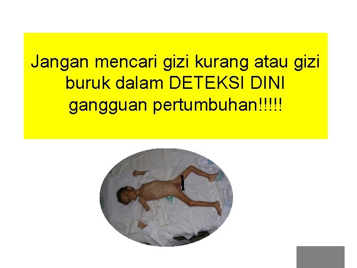 Jangan mencari gizi kurang atau gizi buruk dalam DETEKSI DINI gangguan pertumbuhan!!!!! 
