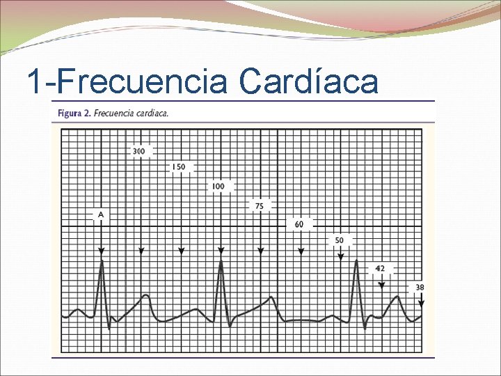 1 -Frecuencia Cardíaca CON RITMO REGULAR: -1500/ Nº de cuadraditos chiquitos entre 2 QRS