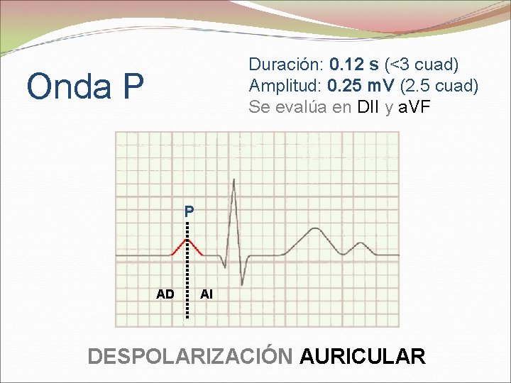 Duración: 0. 12 s (<3 cuad) Amplitud: 0. 25 m. V (2. 5 cuad)