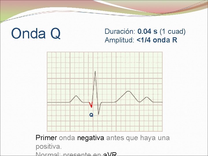 Onda Q Duración: 0. 04 s (1 cuad) Amplitud: <1/4 onda R Q Primer