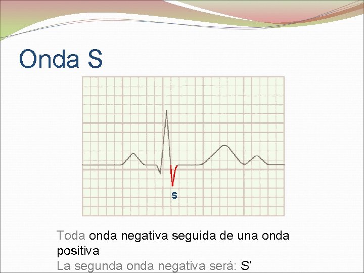 Onda S S Toda onda negativa seguida de una onda positiva La segunda onda