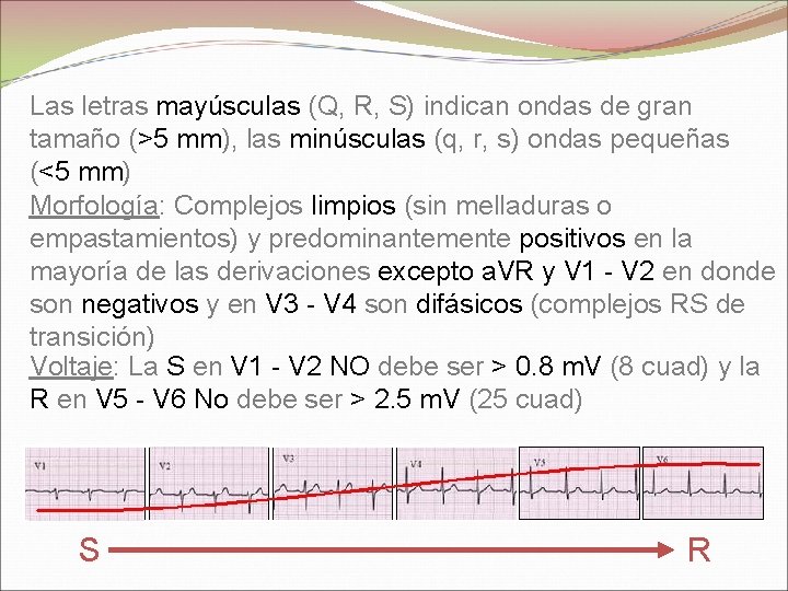 Las letras mayúsculas (Q, R, S) indican ondas de gran tamaño (>5 mm), las