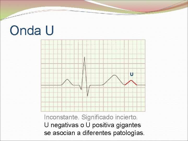 Onda U U Inconstante. Significado incierto. U negativas o U positiva gigantes se asocian