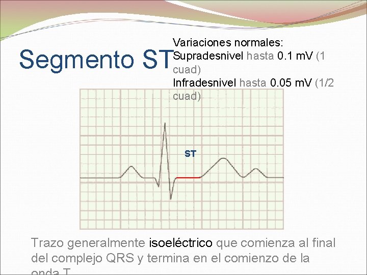 Variaciones normales: Supradesnivel hasta 0. 1 m. V (1 cuad) Infradesnivel hasta 0. 05